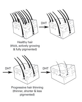 The Hair Loss Centre | What is the normal cycle of hair growth and loss?
